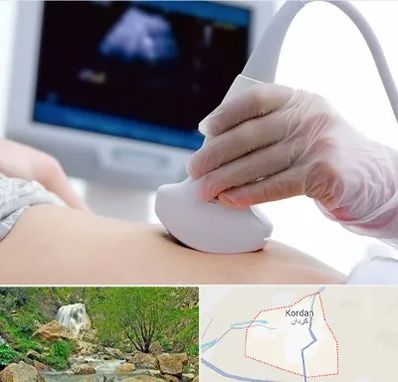 سونوگرافی در کردان