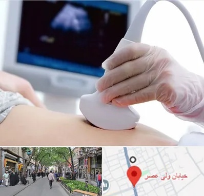 سونوگرافی در ولیعصر شهریار
