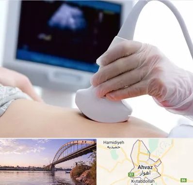 سونوگرافی در اهواز