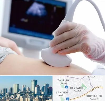 سونوگرافی در قیطریه