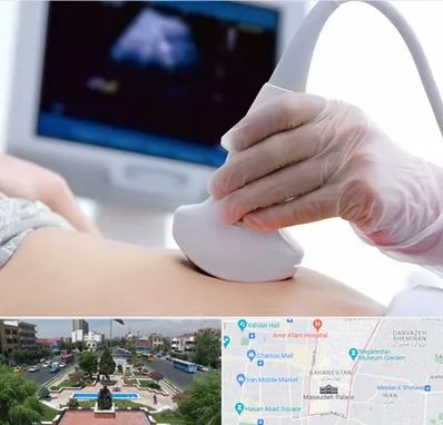 سونوگرافی در بهارستان