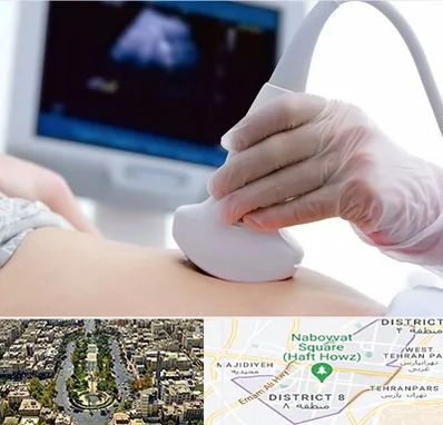 سونوگرافی در نارمک