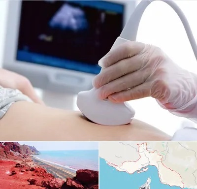 سونوگرافی در هرمزگان