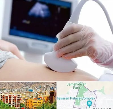 سونوگرافی در نیاوران