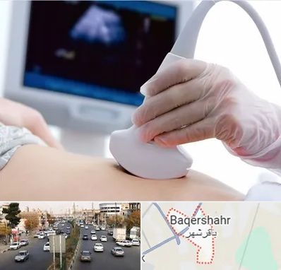 سونوگرافی در باقرشهر