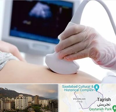 سونوگرافی در زعفرانیه