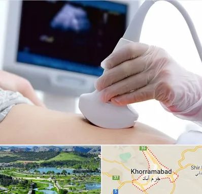 سونوگرافی در خرم آباد