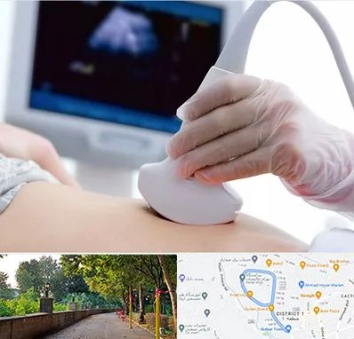 سونوگرافی در فلکه گاز رشت