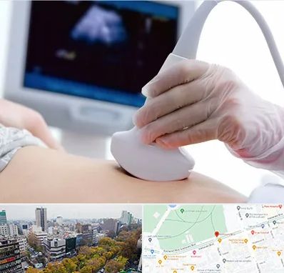 سونوگرافی در بلوار کشاورز