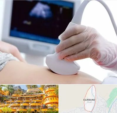 سونوگرافی در دربند