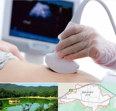 سونوگرافی در بهشهر