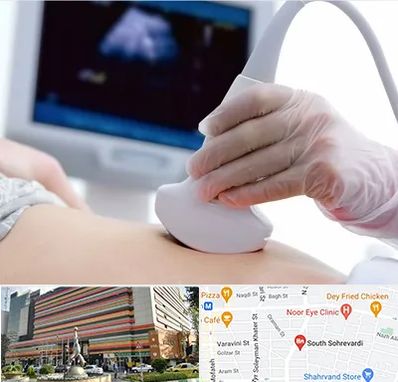 سونوگرافی در سهروردی