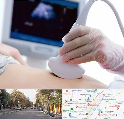 سونوگرافی در شریعتی