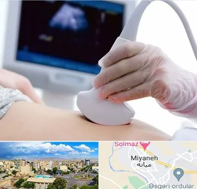 سونوگرافی در میانه