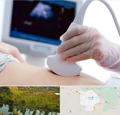 سونوگرافی در بهبهان