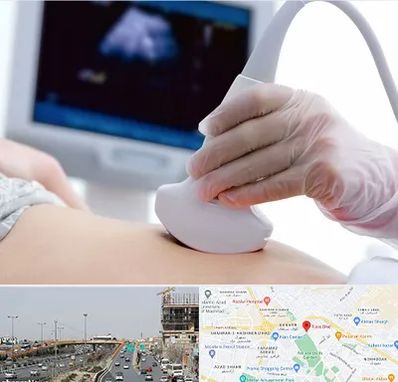 سونوگرافی در بلوار توس مشهد