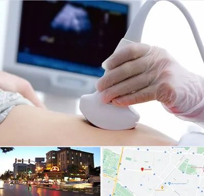 سونوگرافی در بلوار سجاد مشهد