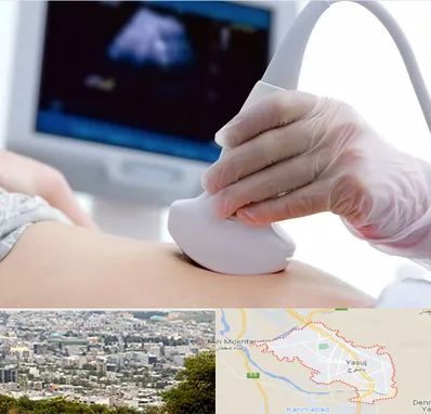 سونوگرافی در یاسوج