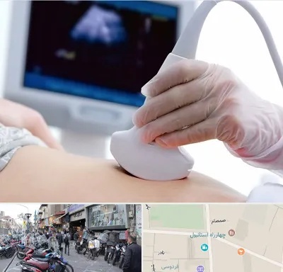 سونوگرافی در چهارراه استانبول