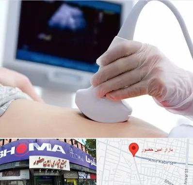 سونوگرافی در امین حضور