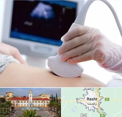 سونوگرافی در رشت