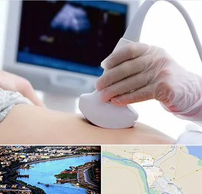 سونوگرافی در خرمشهر