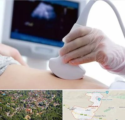 سونوگرافی در دماوند