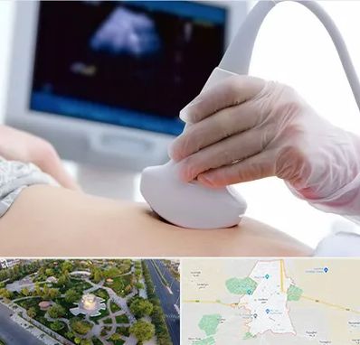 سونوگرافی در کاشمر