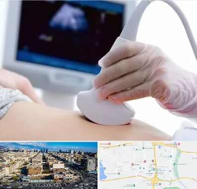 سونوگرافی در شهرک راه آهن