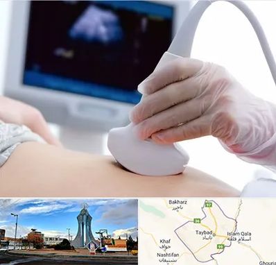 سونوگرافی در تایباد