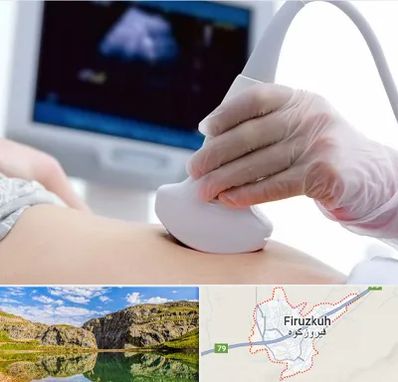 سونوگرافی در فیروزکوه