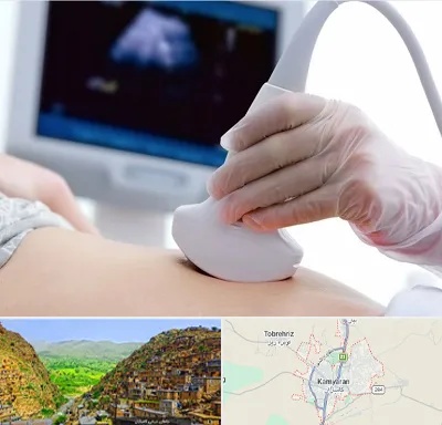 سونوگرافی در کامیاران