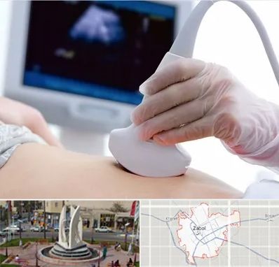 سونوگرافی در زابل