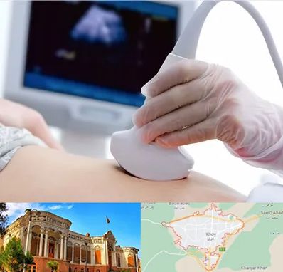 سونوگرافی در خوی