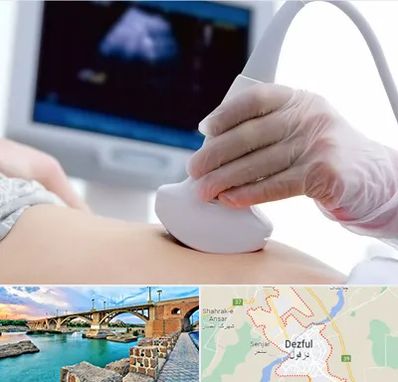 سونوگرافی در دزفول