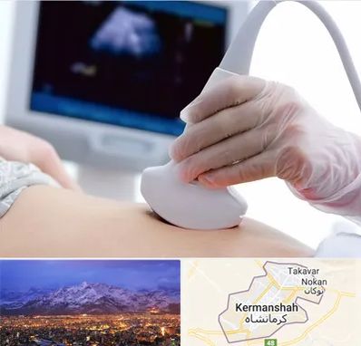 سونوگرافی در کرمانشاه
