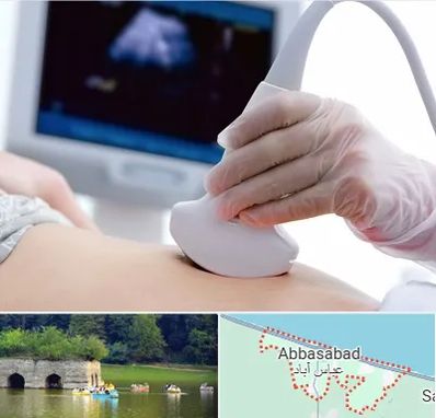 سونوگرافی در عباس آباد