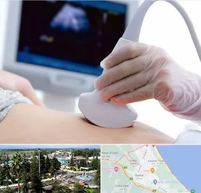 سونوگرافی در رودسر