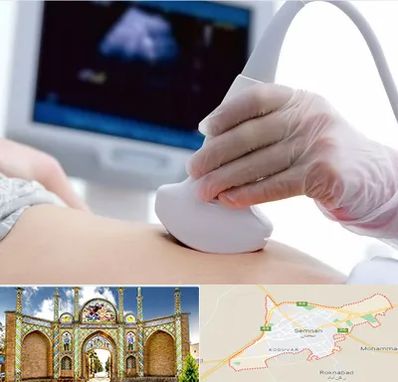 سونوگرافی در سمنان