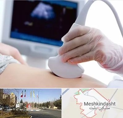 سونوگرافی در مشکین دشت