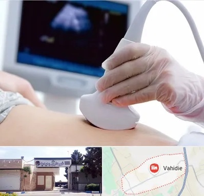 سونوگرافی در وحیدیه شهریار
