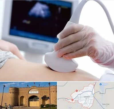 سونوگرافی در ایرانشهر