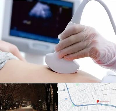 سونوگرافی در ابوریحان تبریز