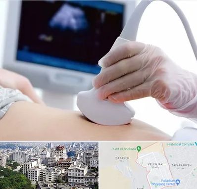 سونوگرافی در ولنجک