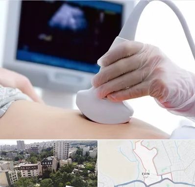 سونوگرافی در اوین