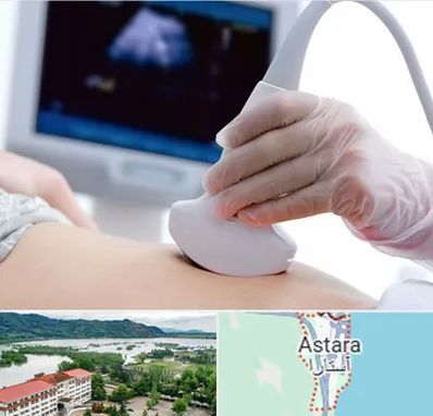 سونوگرافی در آستارا