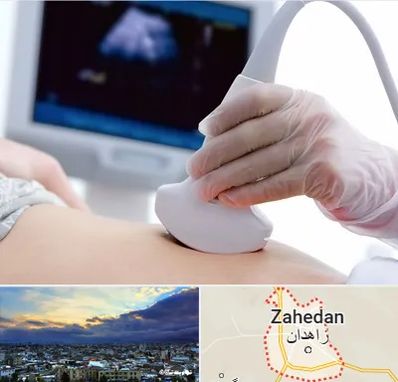 سونوگرافی در زاهدان