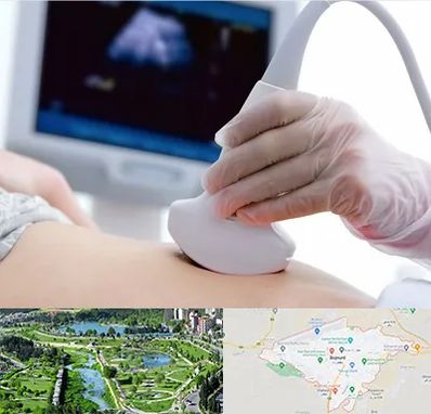 سونوگرافی در بجنورد