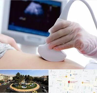 سونوگرافی در هفت حوض