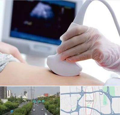 سونوگرافی در توانیر